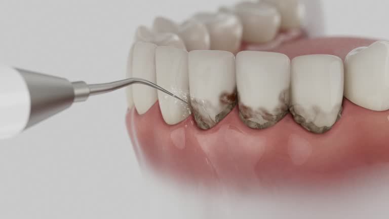 Trusted Dental Crowns And Bridges service in Braddock, VA - Dentist Open Now
